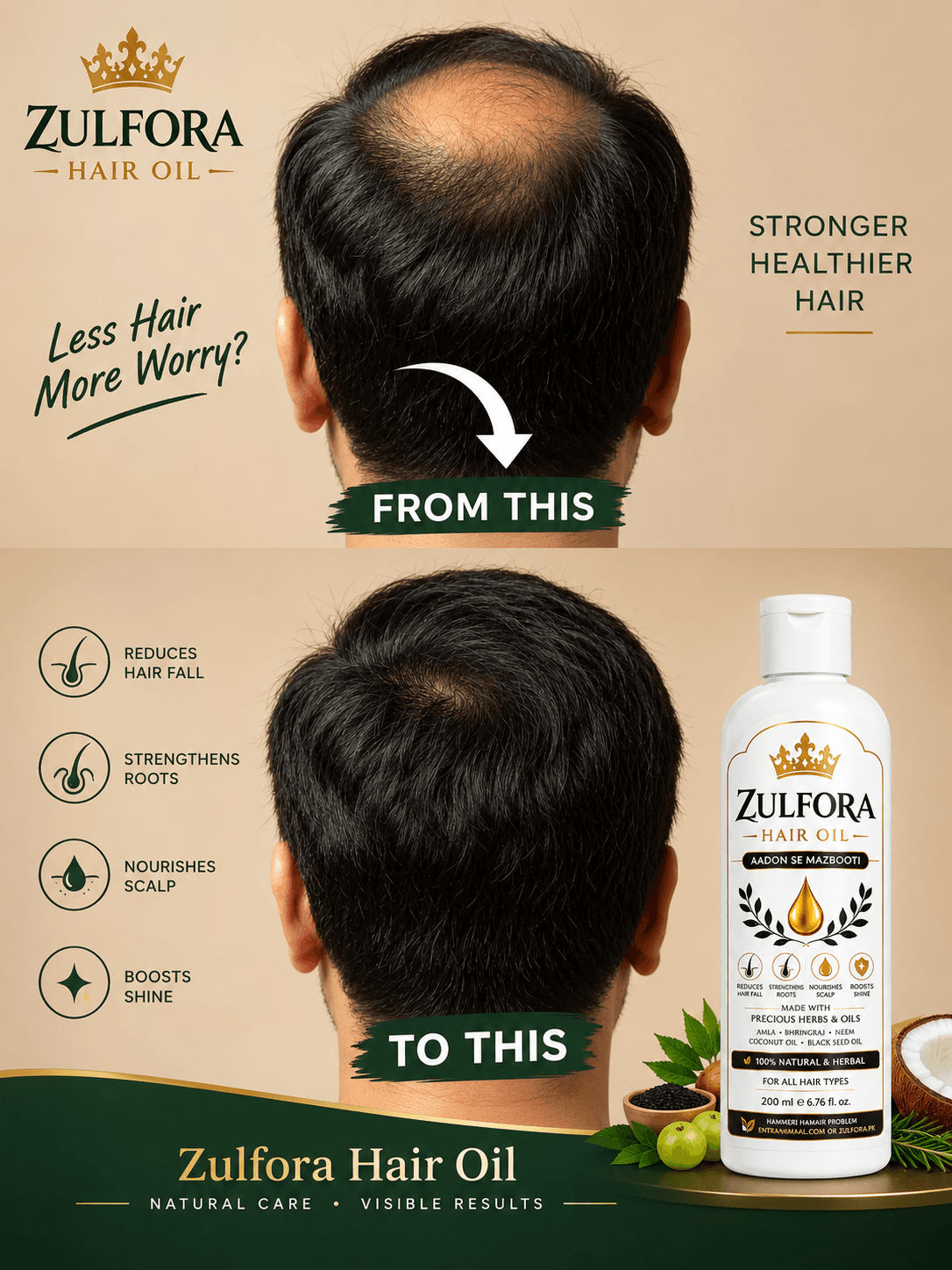Zulfora Hair Oil – 100% Natural & Herbal Hair Oil | 200ml