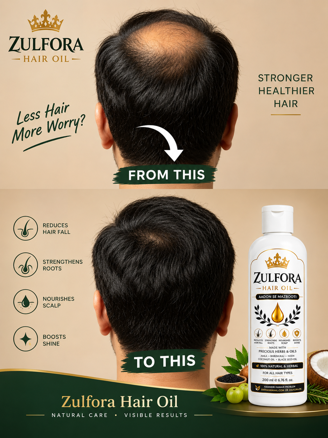 Zulfora Hair Oil – 100% Natural & Herbal Hair Oil | 200ml